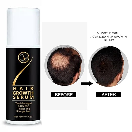 🌿 ThriveStrand™ Hair Revival Serum